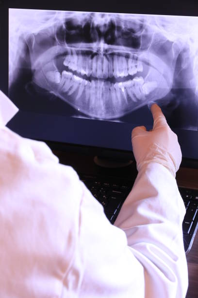 Best Emergency Dental Care for Sports Injuries in Sublette, KS